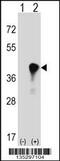 Complement Component 4 Binding Protein Beta antibody, 58-233, ProSci, Western Blot image 