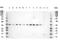 SMAD Family Member 3 antibody, P00059, Boster Biological Technology, Western Blot image 