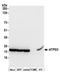 ATP Synthase Peripheral Stalk Subunit OSCP antibody, A305-419A, Bethyl Labs, Western Blot image 