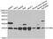 Deoxythymidylate Kinase antibody, abx004870, Abbexa, Western Blot image 