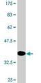 Retinol Binding Protein 2 antibody, H00005948-M02, Novus Biologicals, Western Blot image 