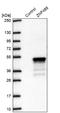 Zinc Finger Protein 488 antibody, NBP2-48819, Novus Biologicals, Western Blot image 
