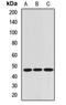 RNA Binding Motif Protein 17 antibody, LS-C668540, Lifespan Biosciences, Western Blot image 