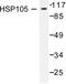 Heat Shock Protein Family H (Hsp110) Member 1 antibody, LS-C176069, Lifespan Biosciences, Western Blot image 