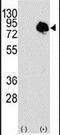 Transglutaminase 2 antibody, PA5-14965, Invitrogen Antibodies, Western Blot image 