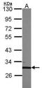 Transcription Factor EC antibody, NBP2-43766, Novus Biologicals, Western Blot image 