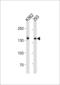 DExH-Box Helicase 9 antibody, LS-C203999, Lifespan Biosciences, Western Blot image 