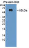 Triggering Receptor Expressed On Myeloid Cells 2 antibody, LS-C727755, Lifespan Biosciences, Western Blot image 