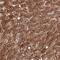 Tonsoku Like, DNA Repair Protein antibody, PA5-61245, Invitrogen Antibodies, Immunohistochemistry paraffin image 