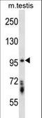 Serine/Threonine Kinase 10 antibody, LS-C164579, Lifespan Biosciences, Western Blot image 