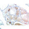 Transthyretin antibody, LS-C813245, Lifespan Biosciences, Immunohistochemistry paraffin image 