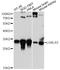 Galectin 3 antibody, LS-C748558, Lifespan Biosciences, Western Blot image 