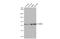 DEAD-Box Helicase 3 Y-Linked antibody, GTX109727, GeneTex, Western Blot image 