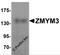 Zinc Finger MYM-Type Containing 3 antibody, 6137, ProSci, Western Blot image 