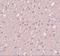 Signal Induced Proliferation Associated 1 Like 3 antibody, A10403, Boster Biological Technology, Immunohistochemistry frozen image 