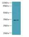 Solute Carrier Family 25 Member 18 antibody, LS-C397440, Lifespan Biosciences, Western Blot image 