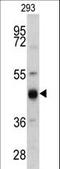 Keratin 13 antibody, LS-C165616, Lifespan Biosciences, Western Blot image 