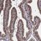 LUC7 Like antibody, PA5-67040, Invitrogen Antibodies, Immunohistochemistry paraffin image 