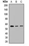 Gamma-Aminobutyric Acid Type A Receptor Alpha3 Subunit antibody, LS-C667804, Lifespan Biosciences, Western Blot image 