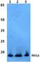 Myosin Light Chain 6 antibody, A09646, Boster Biological Technology, Western Blot image 