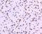 DNA Topoisomerase I antibody, M00434, Boster Biological Technology, Immunohistochemistry paraffin image 