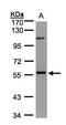 NIMA Related Kinase 3 antibody, PA5-28569, Invitrogen Antibodies, Western Blot image 