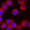 p65 antibody, MAB5078, R&D Systems, Immunocytochemistry image 