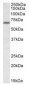 IKAROS Family Zinc Finger 1 antibody, AP23703PU-N, Origene, Western Blot image 