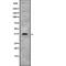 Interleukin 10 Receptor Subunit Beta antibody, abx216187, Abbexa, Western Blot image 