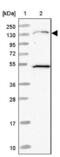 MDS1 And EVI1 Complex Locus antibody, NBP2-48848, Novus Biologicals, Western Blot image 