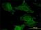 Aldehyde Dehydrogenase 9 Family Member A1 antibody, H00000223-M01, Novus Biologicals, Immunocytochemistry image 