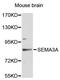 Semaphorin 3A antibody, LS-C748037, Lifespan Biosciences, Western Blot image 