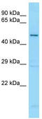 Growth Differentiation Factor 5 antibody, TA343293, Origene, Western Blot image 
