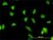 G3BP Stress Granule Assembly Factor 1 antibody, H00010146-M01, Novus Biologicals, Immunocytochemistry image 