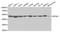 Eukaryotic Translation Initiation Factor 4A1 antibody, STJ27247, St John