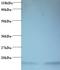 Hemoglobin Subunit Alpha 2 antibody, LS-C210753, Lifespan Biosciences, Western Blot image 