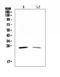 Steroidogenic Acute Regulatory Protein antibody, A00051-1, Boster Biological Technology, Western Blot image 