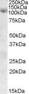 Sorting Nexin 19 antibody, PA5-19008, Invitrogen Antibodies, Western Blot image 