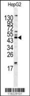 Homer Scaffold Protein 1 antibody, MBS9202017, MyBioSource, Western Blot image 