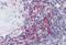 Vav Guanine Nucleotide Exchange Factor 3 antibody, orb18879, Biorbyt, Immunohistochemistry paraffin image 