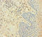 CAPZA2 antibody, A50093-100, Epigentek, Immunohistochemistry paraffin image 
