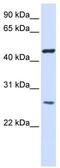 Transmembrane protein 127 antibody, TA342042, Origene, Western Blot image 