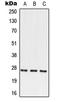 Paired mesoderm homeobox protein 2 antibody, LS-C353835, Lifespan Biosciences, Western Blot image 