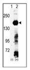 Lysine Demethylase 4A antibody, AP11068PU-N, Origene, Western Blot image 