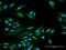 Protein Phosphatase 1 Regulatory Inhibitor Subunit 1C antibody, H00151242-D01P, Novus Biologicals, Immunofluorescence image 
