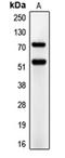 Carcinoembryonic Antigen Related Cell Adhesion Molecule 1 antibody, orb213603, Biorbyt, Western Blot image 