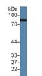 Complement Factor B antibody, LS-C297862, Lifespan Biosciences, Western Blot image 