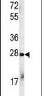 STIP1 Homology And U-Box Containing Protein 1 antibody, PA5-13419, Invitrogen Antibodies, Western Blot image 