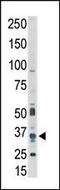 Pim-1 Proto-Oncogene, Serine/Threonine Kinase antibody, MBS9205400, MyBioSource, Western Blot image 