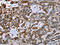 Inosine Monophosphate Dehydrogenase 2 antibody, CSB-PA914299, Cusabio, Immunohistochemistry paraffin image 